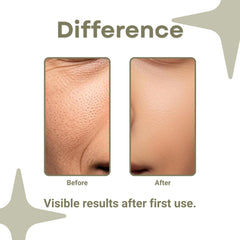 GlowMera Advanced Hydration Cleanser 100ml – Snail Mucin + Aloe Vera + Hyaluronic Acid | Deep Clean, Moisturizing, Skin Barrier Repair | For All Skin Types