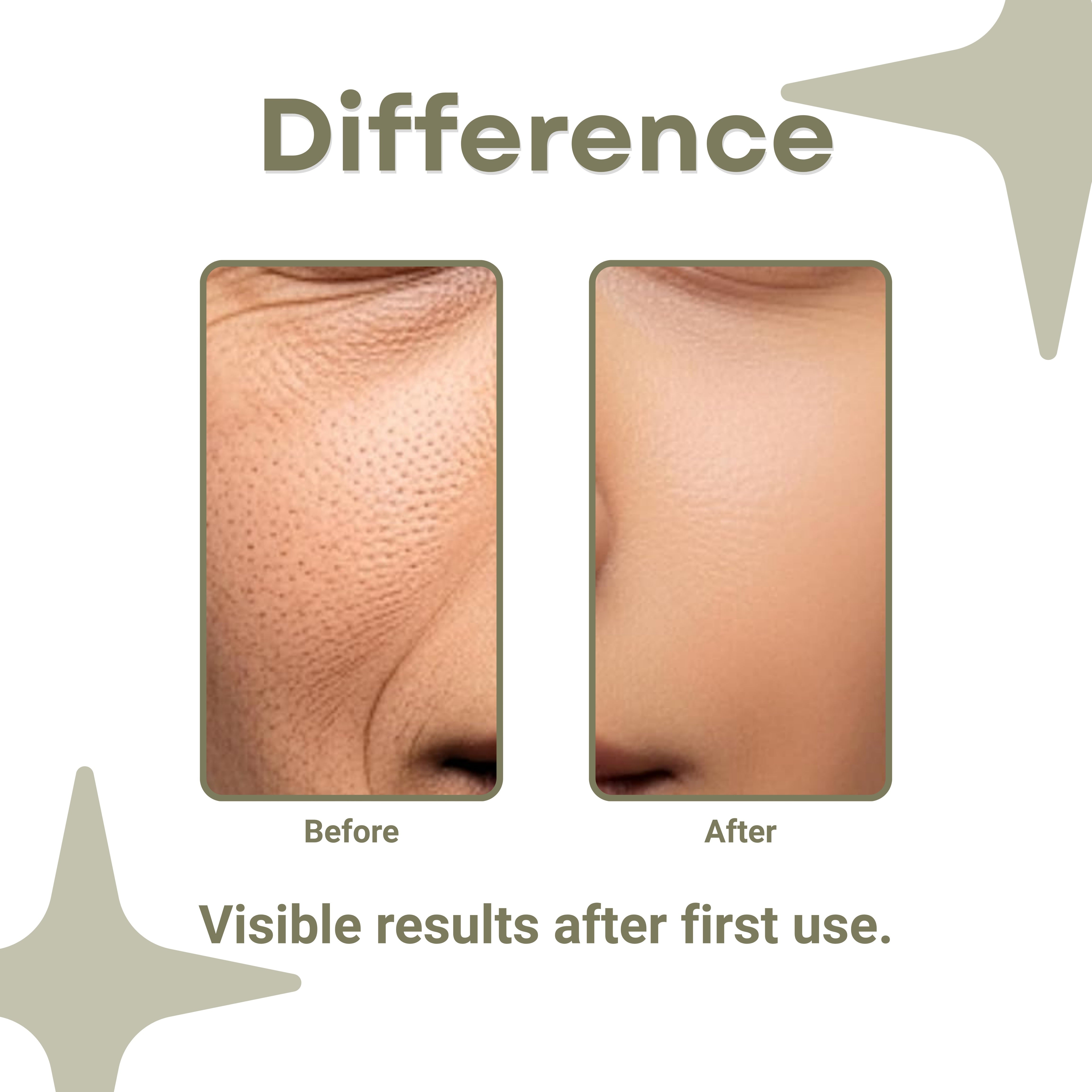 GlowMera Co Soft Daily Brightening & Moisturizing Cream with Vitamin C, Niacinamide & SPF Skin Barrier Repair 50g